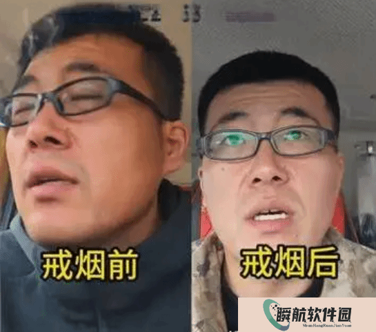 烟龄22年老烟民坚持戒烟92天前后对比：变化巨大