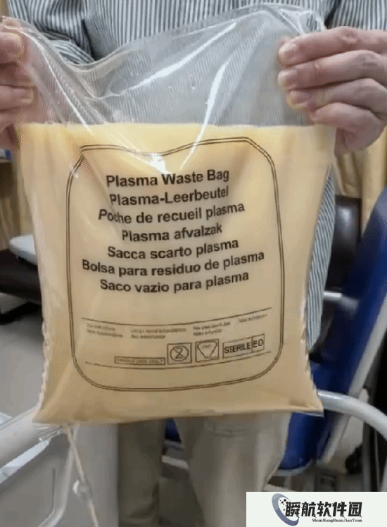 男子聚餐后体内滤出7斤油 当场吓懵：这么一大袋