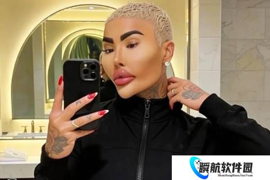 整形明星“唇王”乔丹·詹姆斯·帕克疑因整形离世 两人涉嫌过失杀人被捕