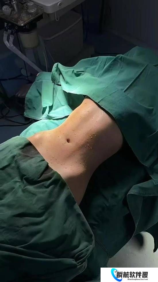 女子花10万做折角腰整形 醒来后浑身血水