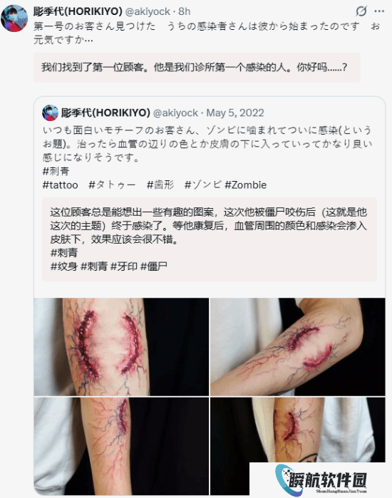 谁是下一个？纹身师晒顾客感染者咬痕纹身